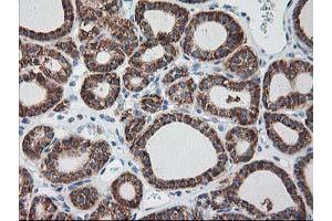 Image no. 11 for anti-Ribophorin 1 (RPN1) antibody (ABIN1500748) (RPN1 anticorps)