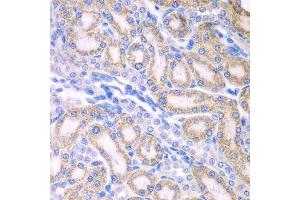 Immunohistochemistry of paraffin-embedded rat kidney using ALDH1A2 antibody.