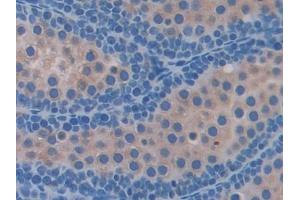 Detection of FTMT in Mouse Testis Tissue using Polyclonal Antibody to Ferritin, Mitochondrial (FTMT)