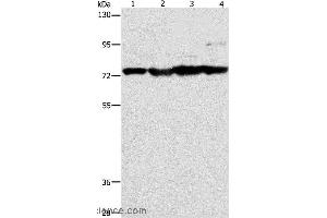 Western blot analysis of Mouse stomach, heart and liver tissue, HT-29 cell, using MMP15 Polyclonal Antibody at dilution of 1:200 (MMP15 anticorps)