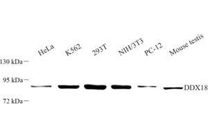 Western blot analysis of DDX18 (ABIN7073695) at dilution of 1: 500 (DDX18 anticorps)