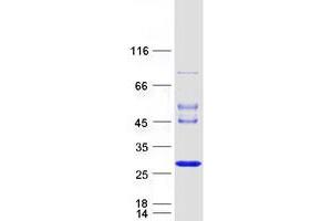 Validation with Western Blot (JOSD1 Protein (Myc-DYKDDDDK Tag))