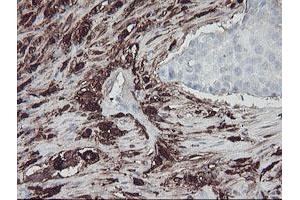 Image no. 9 for anti-Coagulation Factor XIII, A1 Polypeptide (F13A1) antibody (ABIN1498150)