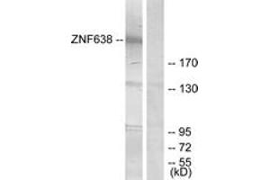 Western blot analysis of extracts from HepG2 cells, treated with serum 20% 15', using ZNF638 Antibody. (ZNF638 anticorps  (AA 1271-1320))