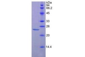Image no. 1 for CD47 (CD47) (AA 18-219) (Active) protein (His tag) (ABIN6239909)
