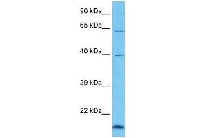 Host:  Rabbit  Target Name:  GRHL3  Sample Tissue:  Human 786-0 Whole Cell  Antibody Dilution:  1ug/ml (GRHL3 anticorps  (C-Term))