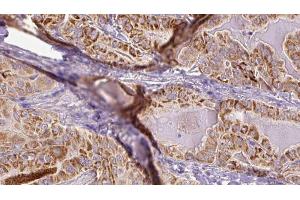 anti-TBC1 Domain Family, Member 4 (TBC1D4) (pSer318) antibody