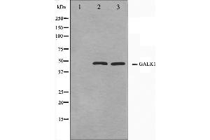 Western blot analysis on NIH-3T3 and HeLa cell lysate using GALK1 Antibody,The lane on the left is treated with the antigen-specific peptide. (GALK1 anticorps  (C-Term))