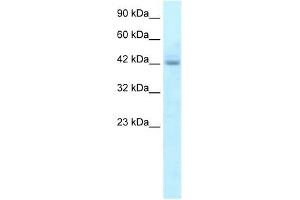 RGS20 antibody used at 5 ug/ml to detect target protein.