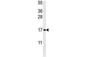 CCL4 antibody western blot analysis in mouse bladder tissue lysate (15ug/lane). (CCL4 anticorps  (AA 22-48))