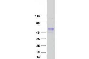 Validation with Western Blot