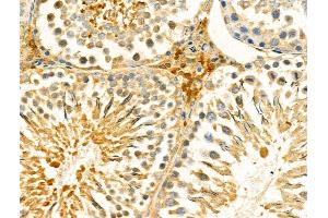 ABIN7094289 and ABIN7098336 at 1/100 staining Rat testis tissue by IHC-P.