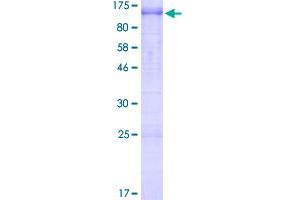 SDS-PAGE (SDS) image for Metadherin (MTDH) (AA 1-582) protein (GST tag) (ABIN1800409)