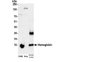 Western Blotting (WB) image for anti-Hemoglobin antibody (Biotin) (ABIN7449345)