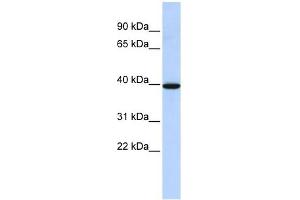 NMBR antibody used at 1 ug/ml to detect target protein. (NMBR anticorps  (N-Term))