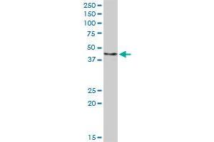 FBXO4 MaxPab rabbit polyclonal antibody. (FBXO4 anticorps  (AA 1-387))
