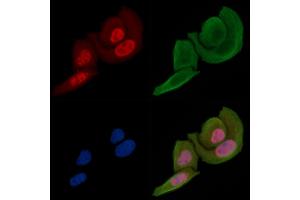 ABIN6255471 and ABIN6267267 staining Hela cells(30 min of UV treatment) by IF/ICC.