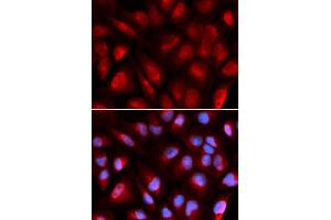 Immunofluorescence analysis of U2OS cells using MCM5 antibody (ABIN5973237). (MCM5 anticorps)