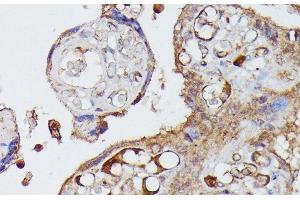 Immunohistochemistry of paraffin-embedded Human placenta using AGT Polyclonal Antibody at dilution of 1:100 (40x lens). (AGT anticorps)