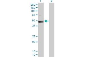 Western Blot analysis of SMARCB1 expression in transfected 293T cell line by SMARCB1 MaxPab polyclonal antibody.