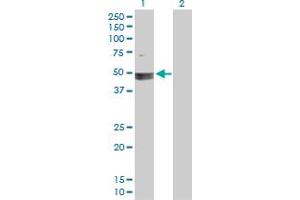 Western Blot analysis of SMARCB1 expression in transfected 293T cell line by SMARCB1 MaxPab polyclonal antibody. (SMARCB1 anticorps  (AA 1-385))