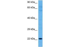 Host:  Rabbit  Target Name:  KRTAP27-1  Sample Tissue:  Human RPMI 8226 Whole Cell lysates  Antibody Dilution:  1ug/ml