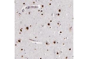 Immunohistochemical staining of human cerebral cortex with NUP62CL polyclonal antibody  shows strong nuclear positivity in neuronal cells at 1:200-1:500 dilution. (NUP62CL anticorps)