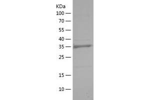 Western Blotting (WB) image for Hypoxia Inducible Factor 1, alpha Subunit (Basic Helix-Loop-Helix Transcription Factor) (HIF1A) (AA 574-799) protein (His tag) (ABIN7123397)