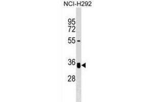 Western Blotting (WB) image for anti-N-Acetylglucosamine-1-Phosphate Transferase, gamma Subunit (GNPTG) antibody (ABIN3000049) (GNPTG anticorps)