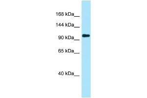 WB Suggested Anti-PKP4 Antibody Titration: 1. (Plakophilin 4 anticorps  (N-Term))