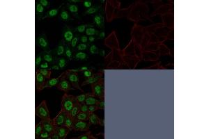 Confocal Immunofluorescence image of HeLa cells using Topo II alpha, Monoclonal Antibody (TOP2A/1361). (Topoisomerase II alpha anticorps  (AA 1352-1493))