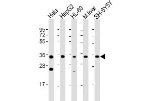 All lanes : Anti-ADORA3 Antibody (C-Term) at 1:2000 dilution Lane 1: Hela whole cell lysate Lane 2: HepG2 whole cell lysate Lane 3: HL-60 whole cell lysate Lane 4: mouse liver lysate Lane 5: SH-SY5Y whole cell lysate Lysates/proteins at 20 μg per lane. (Adenosine A3 Receptor anticorps  (AA 202-232))