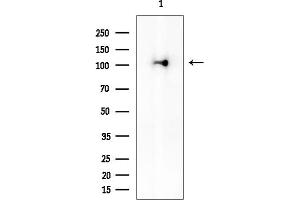 anti-Staphylococcal Nuclease Domain Containing Protein 1 (SND1) antibody