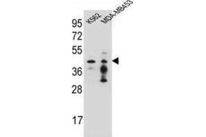 Western Blotting (WB) image for anti-Phosphate Cytidylyltransferase 1, Choline, alpha (PCYT1A) antibody (ABIN2996564) (PCYT1A anticorps)
