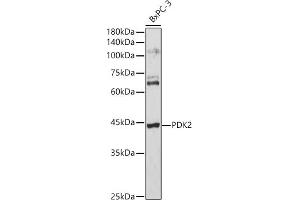 Western blot analysis of extracts of BxPC-3 cells, using PDK2 antibody (ABIN1681304, ABIN3018413, ABIN3018414 and ABIN6220461) at 1:3000 dilution. (PDK2 anticorps  (AA 128-407))