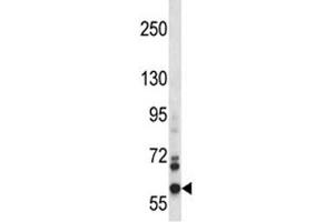 NOX5 antibody western blot analysis in CEM lysate. (NOX5 anticorps  (AA 680-709))