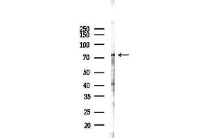 Western blot analysis of lysates from Mouse lung, using MX1 Antibody at 1/1000 dilution.