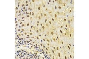 Immunohistochemistry of paraffin-embedded human esophagus using KRT8 Antibody.