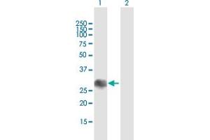 Western Blot analysis of SOCS1 expression in transfected 293T cell line by SOCS1 MaxPab polyclonal antibody. (SOCS1 anticorps  (AA 1-211))