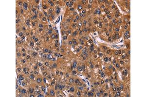 Immunohistochemistry (IHC) image for anti-Nuclear Factor of Activated T-Cells, Cytoplasmic, Calcineurin-Dependent 3 (NFATC3) antibody (ABIN2428466) (NFATC3 anticorps)