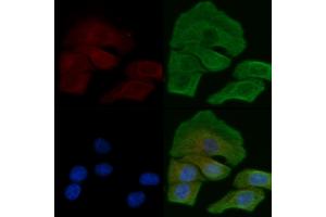 ABIN6258662 and ABIN6275251 staining Hela cells by IF/ICC.