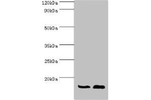 Western blot All lanes: ATP5J antibody at 7 μg/mL Lane 1: Rat brain tissue Lane 2: Mouse heart tissue Secondary Goat polyclonal to rabbit IgG at 1/10000 dilution Predicted band size: 13, 14 kDa Observed band size: 13 kDa (ATP5J anticorps  (AA 1-108))