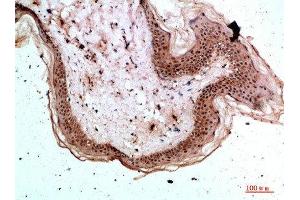 Immunohistochemical analysis of paraffin-embedded human-skin, antibody was diluted at 1:200