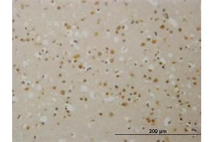 Immunoperoxidase of monoclonal antibody to TBL1X on formalin-fixed paraffin-embedded human cerebral cortex.