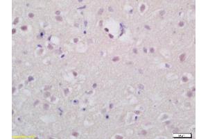 Formalin-fixed and paraffin embedded rat brain labeled with Rabbit Anti-TSHR Polyclonal Antibody (ABIN677378) at 1:200 followed by conjugation to the secondary antibody and DAB staining (TSH receptor anticorps  (AA 201-300))