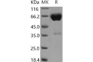 Western Blotting (WB) image for CD2 (CD2) protein (Fc Tag) (ABIN7321206) (CD2 Protein (CD2) (Fc Tag))