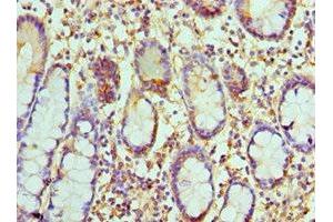 Immunohistochemistry of paraffin-embedded human small intestine tissue using ABIN7146018 at dilution of 1:100