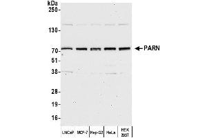 Western Blotting (WB) image for anti-Poly A Specific Ribonuclease (PARN) (AA 589-639) antibody (ABIN7454930) (PARN anticorps  (AA 589-639))