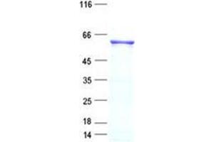 Validation with Western Blot