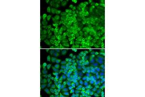 Immunofluorescence analysis of HeLa cells using Galactosidase alpha (Galactosidase alpha (GLA)) antibody (ABIN6131511, ABIN6141114, ABIN6141116 and ABIN6218799).